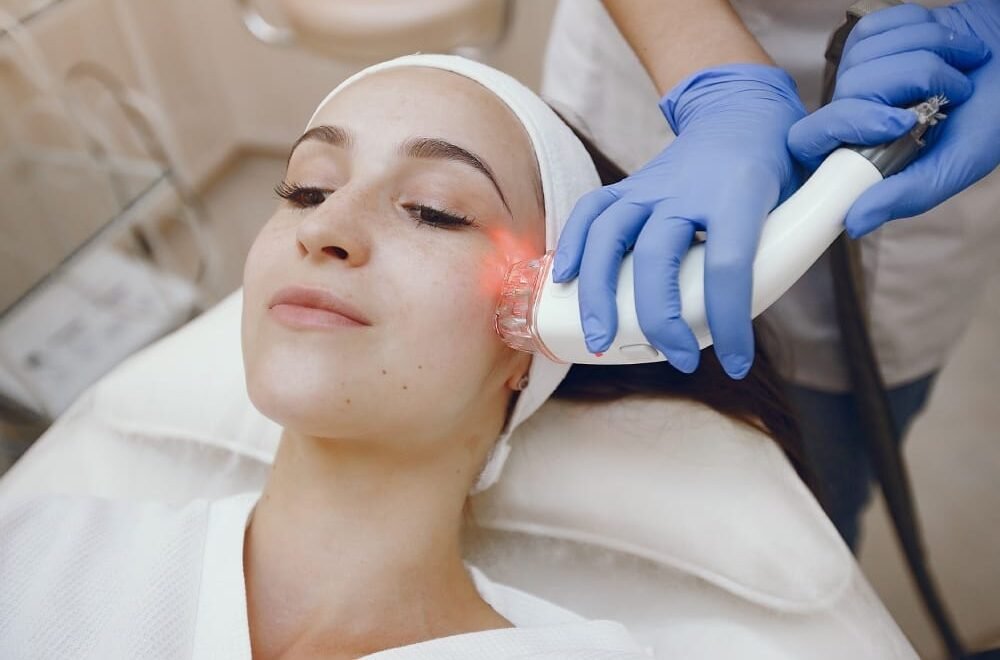 Fractional Laser 2