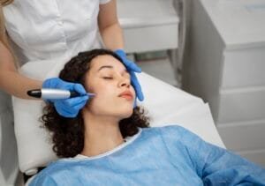 Microneedling