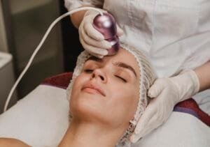 Radiofrequency (RF) Skin Tightening