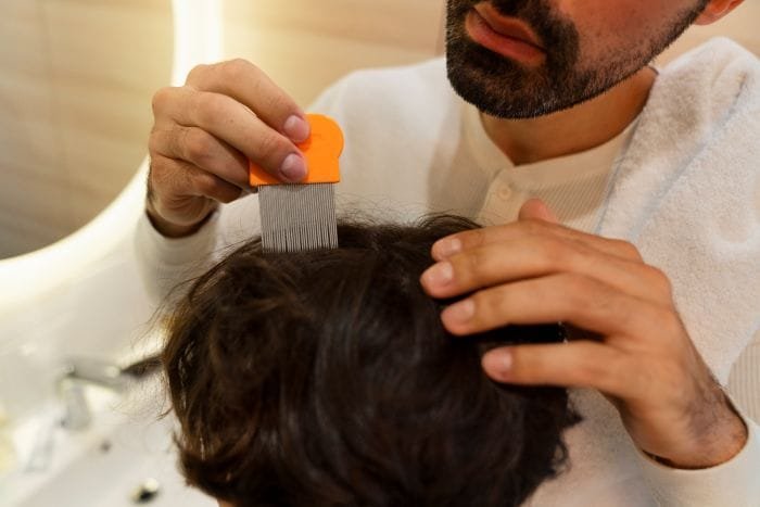 Microneedling hairfall treatment Microneedling hairfall treatment