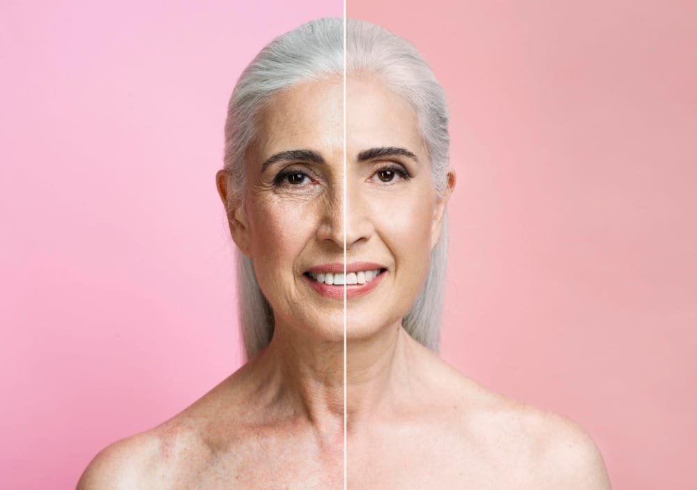 before after portrait of anti aging treatment before after portrait of anti aging treatment