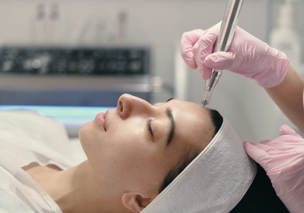 Derma Pen Derma Pen