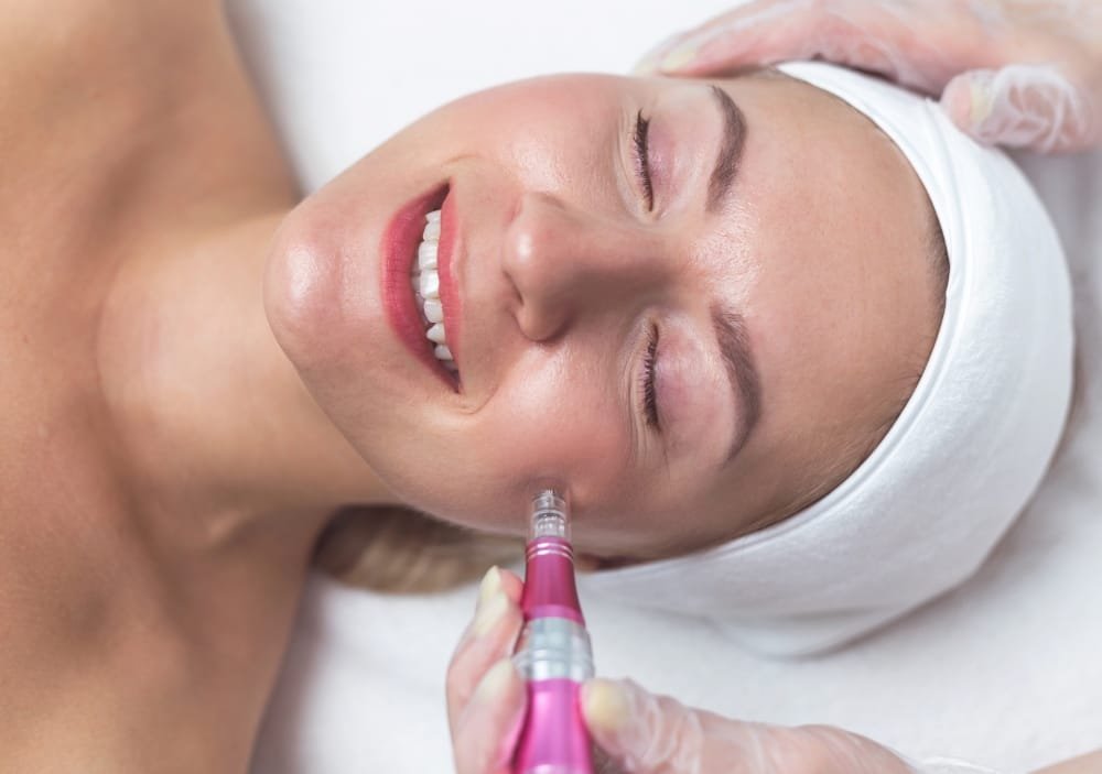How Klarity Treats Acne Scars