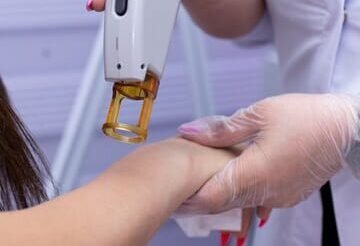 Targeted Laser Skin Treatment for Flawless Skin