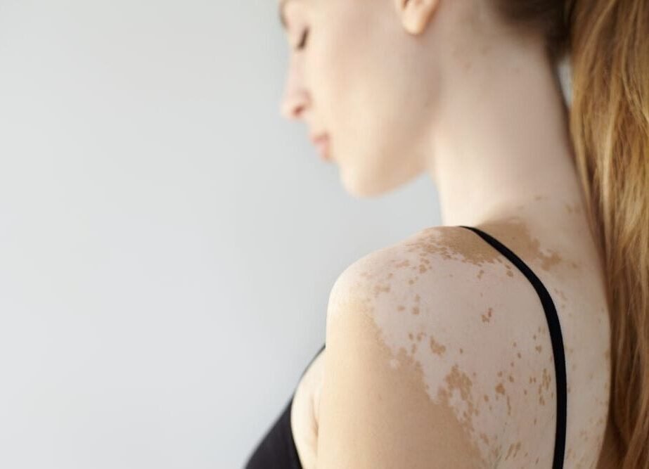 Clinical Dermatology