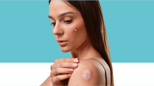 Clinical Dermatology