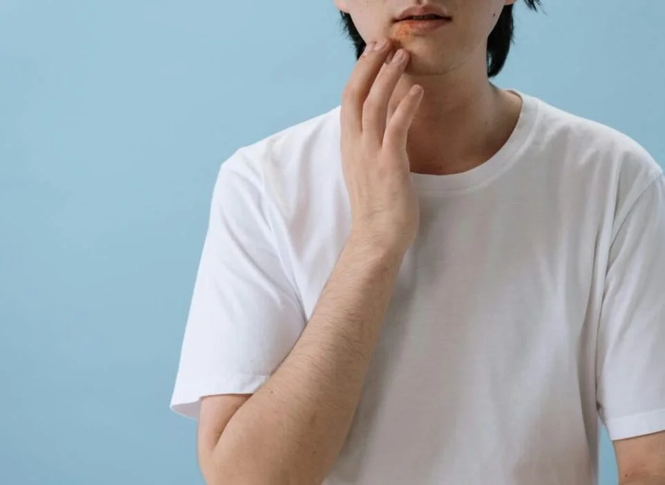 Cold Sores: What They Are and Why They Happen
