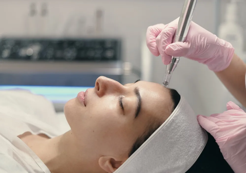 How to Prepare for a Dermapen Microneedling Procedure?