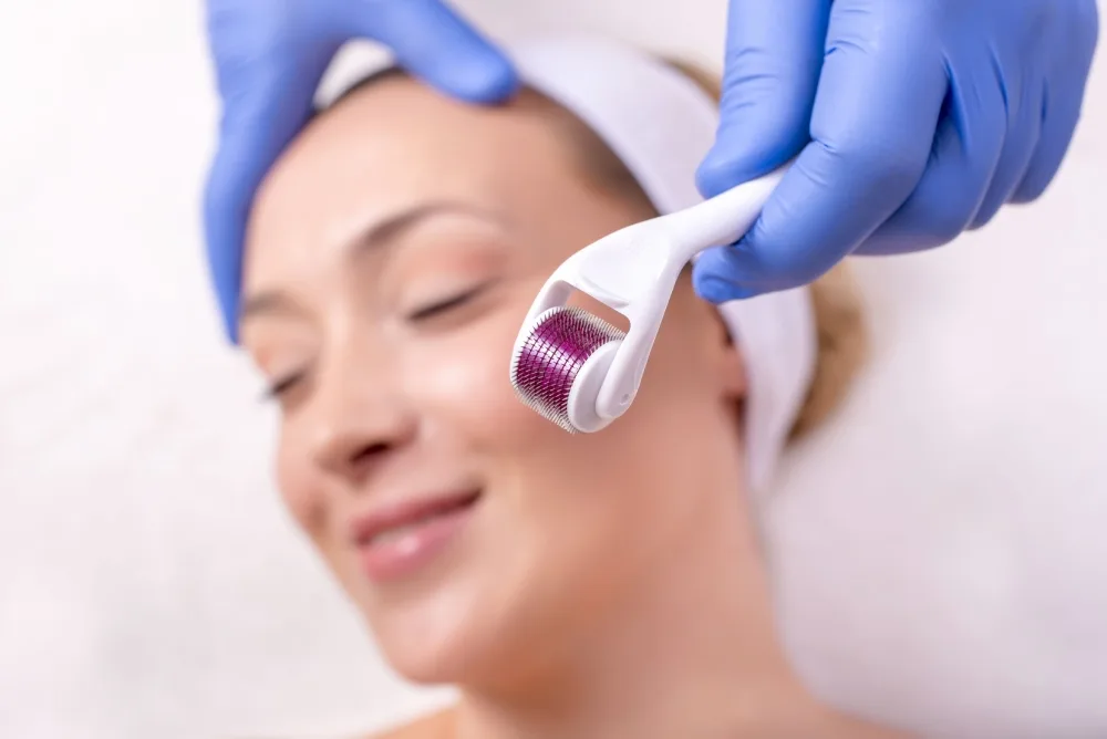Ditch Scar Creams—Dermaroller Provides Faster, Visible Results