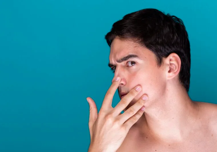 Effective Treatments for Acne: Peels, Microneedling, PRP & Laser