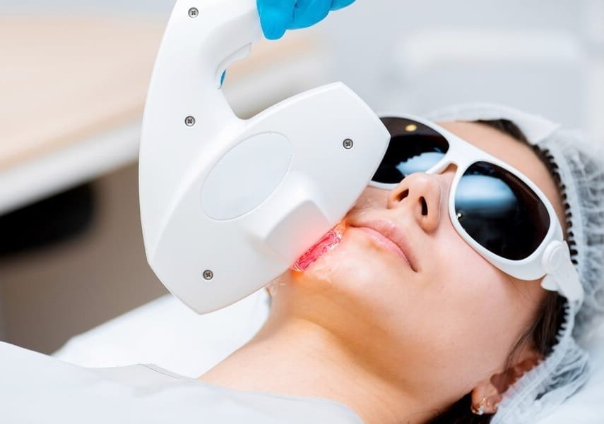 Laser Beard Shaping and Earlobe Hair Removal for a Clean, Defined Look