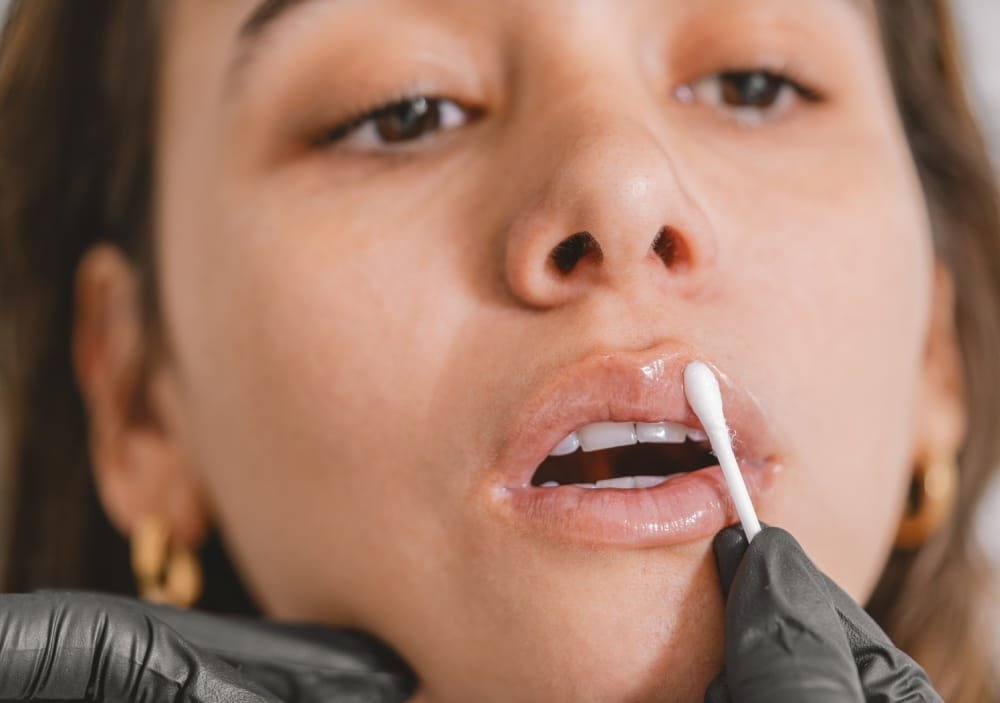 Are Lip Fillers Safe?