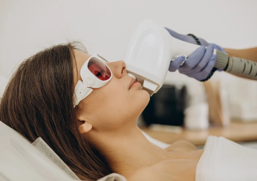 Q Switched laser treatment