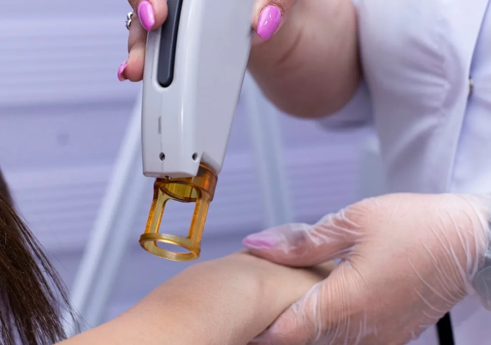 6. Is Q-Switch Laser Right for You?