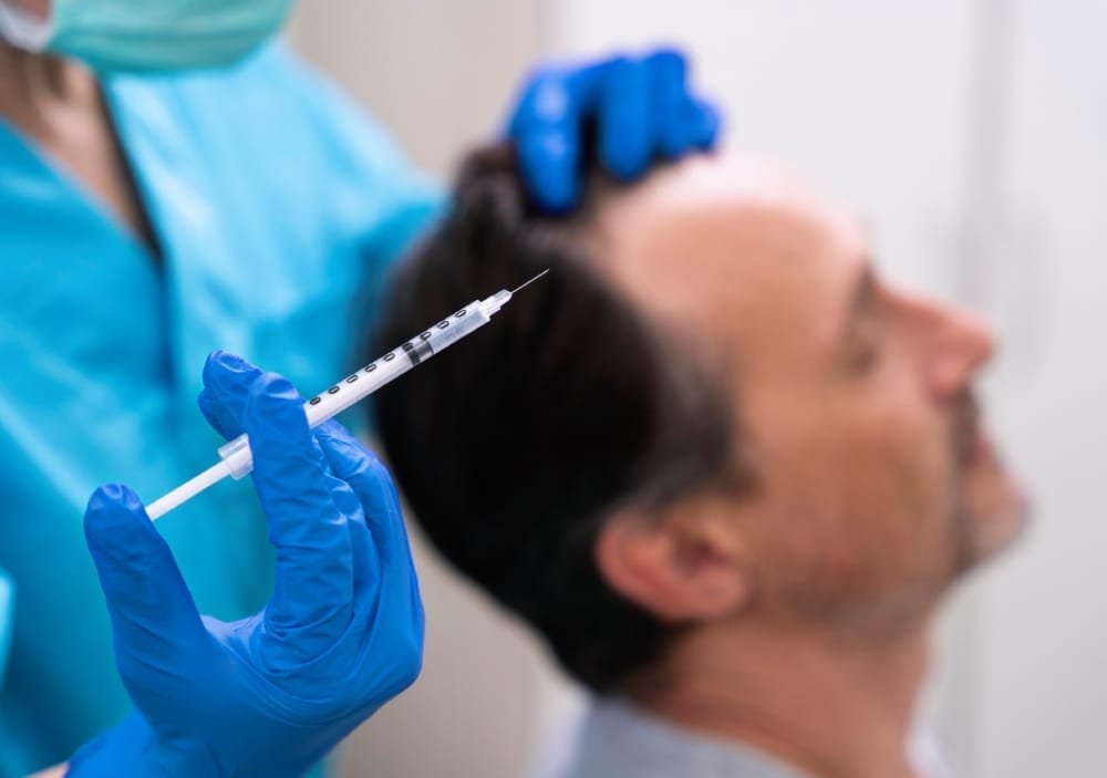 Regenera Activa: The ultimate Solution for Hair Loss & Thinning