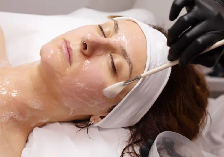 Chemical Peels – Quick Refresh for Radiant Skin