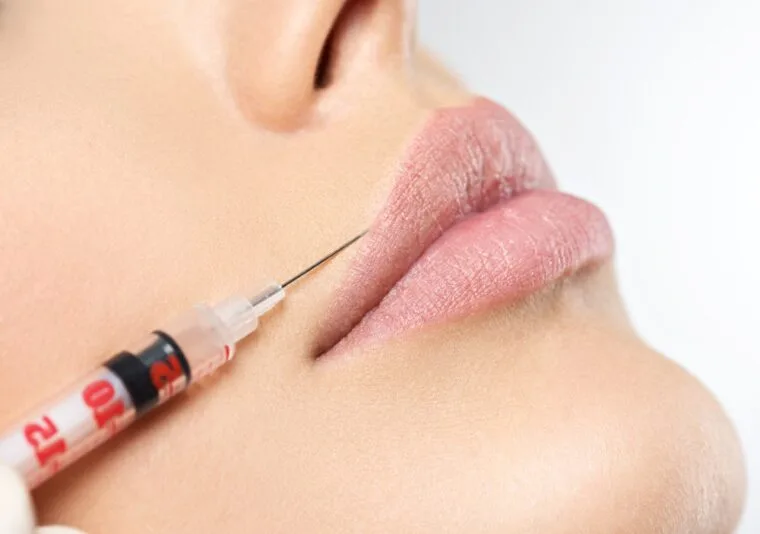 How long do filler cost