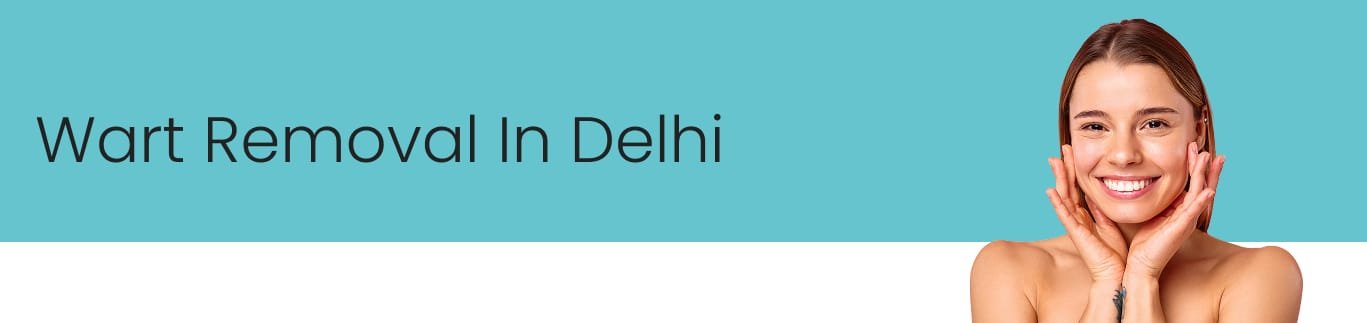 Best Warts Removal Treatment in Delhi Best Warts Removal Treatment in Delhi