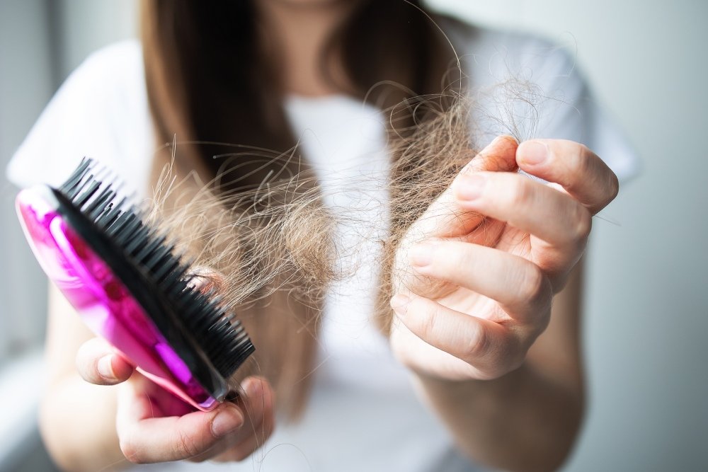 Which Vitamin Deficiency Causes Hair Loss?