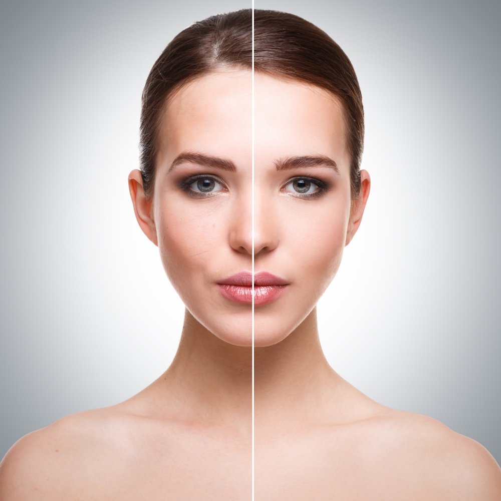 Skin Brightening and pigmentation
