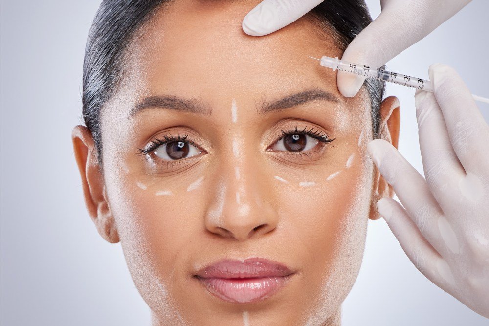 Who Should Consider Botox?