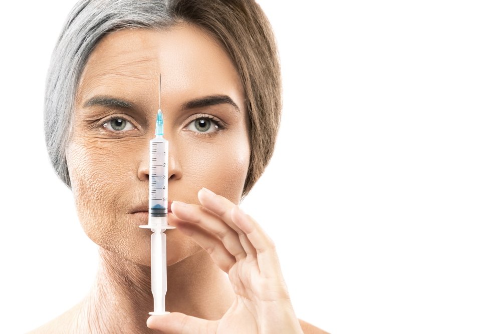 MNRF Treatment for Wrinkles and Fine Lines