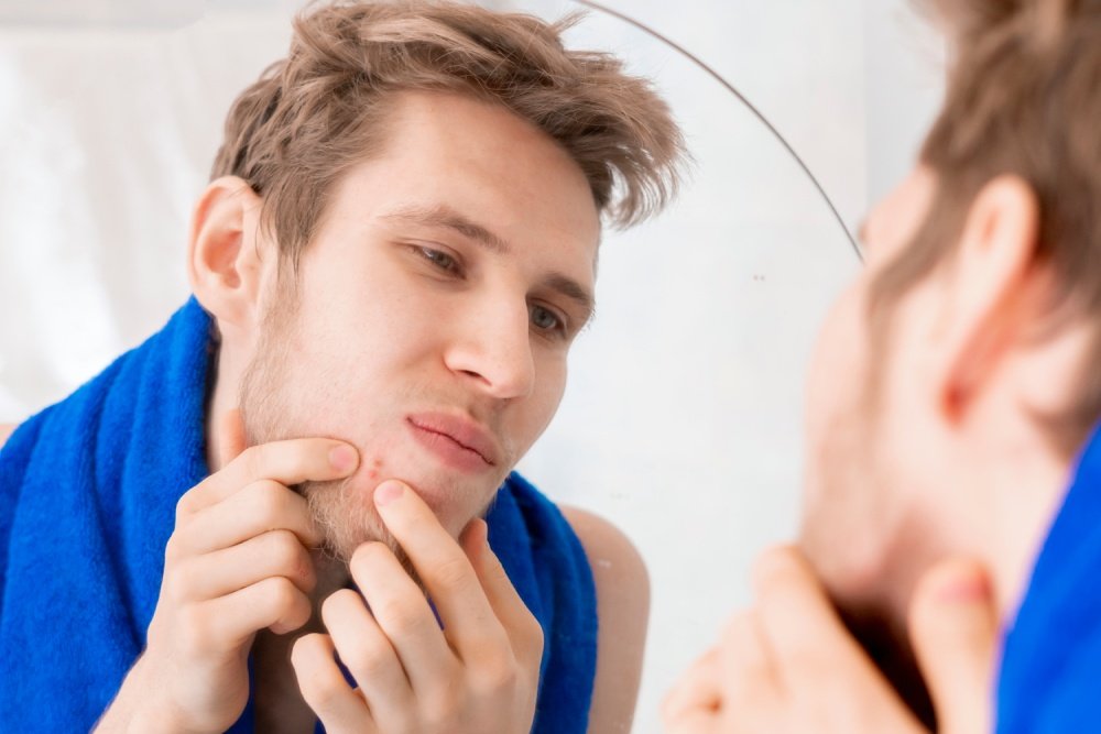 Common Skin Concerns Grooms Face Before the Wedding
