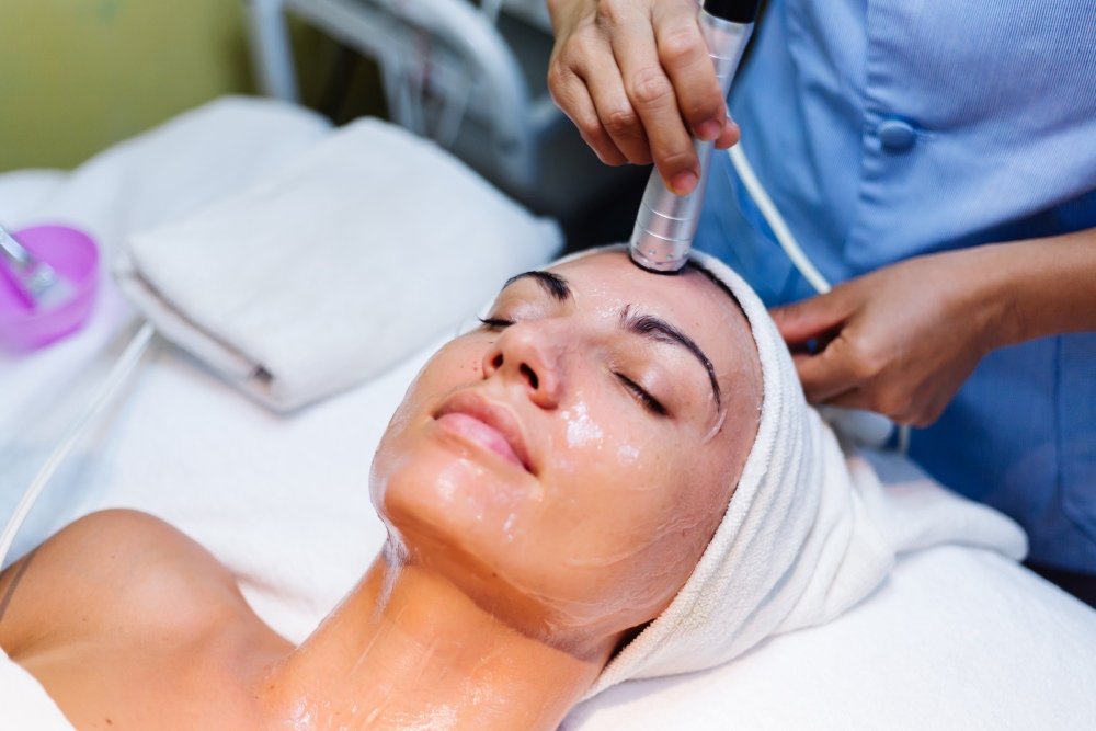 MNRF Treatment for Acne Scars