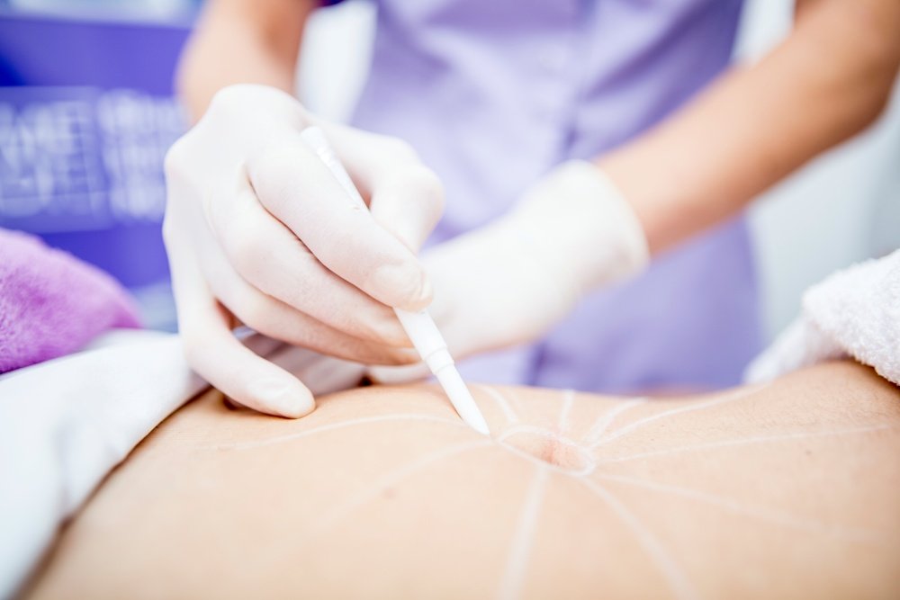 mounjaro treatment in new delhi