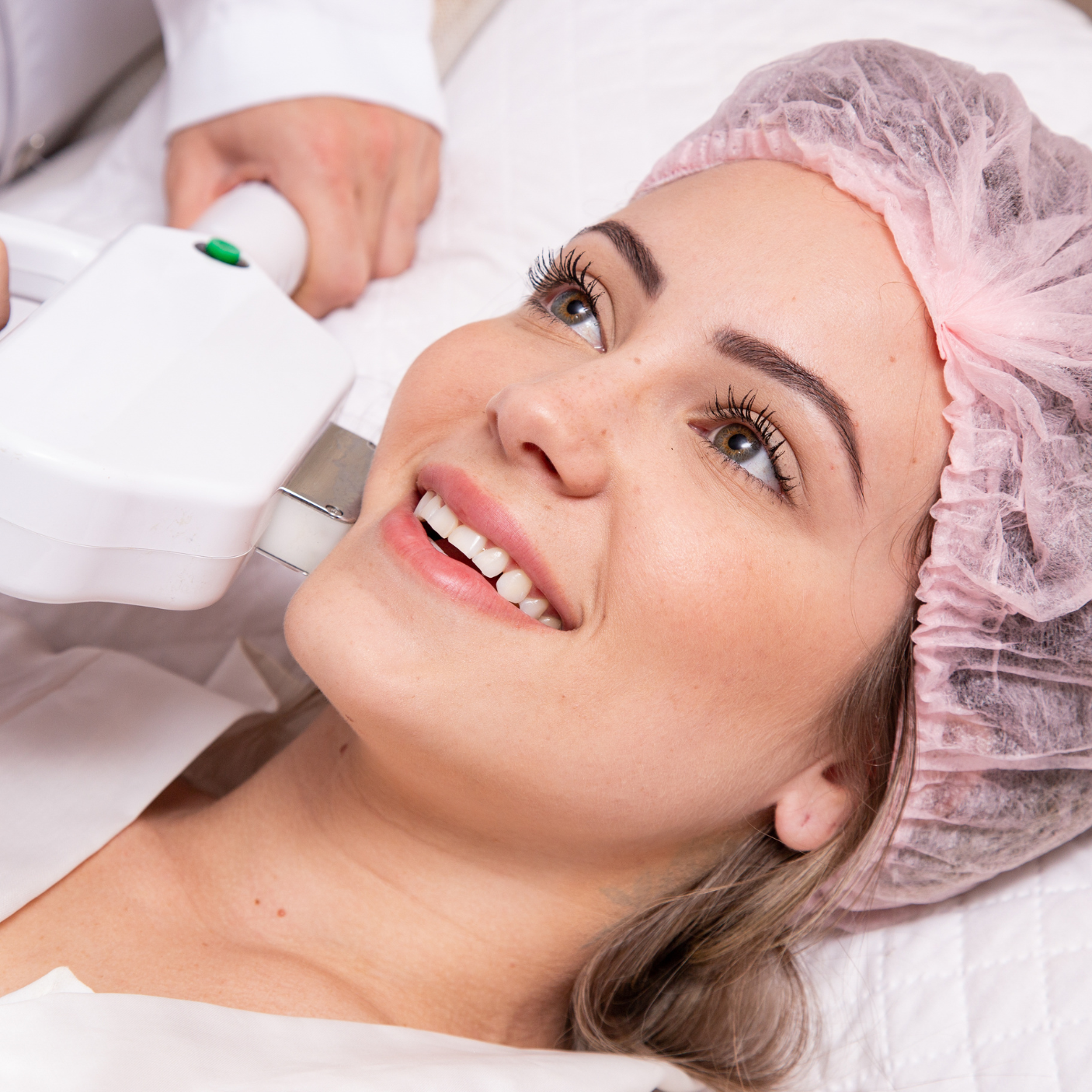 Hormonal Hair Growth in Women: Why Laser Hair Removal Is a Popular Summer Solution