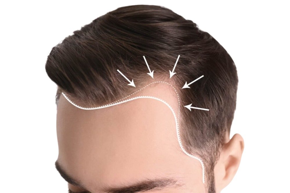 Tips to Support Hair Growth Naturally