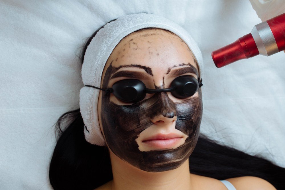 Cost of Laser Pigmentation Treatment