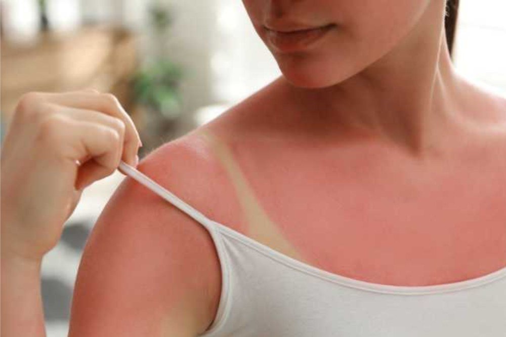 Best Tan Removal Treatment in Delhi for Bright and Even Skin