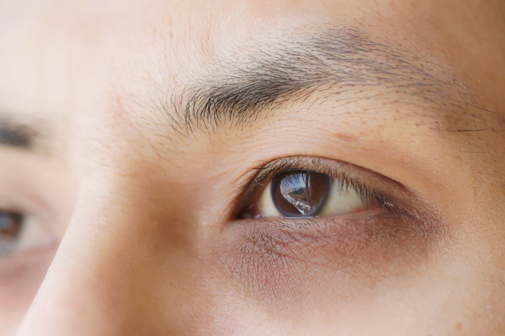 Ready to Brighten Your Eyes?
