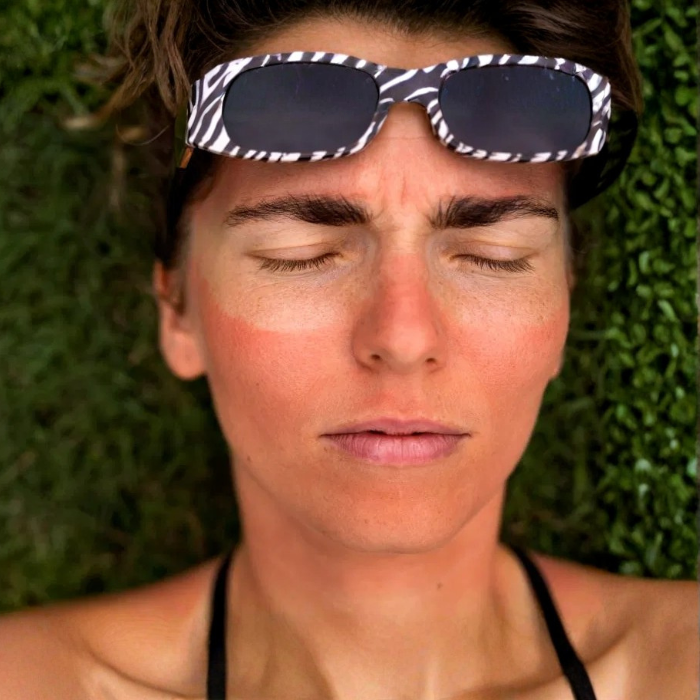 Best Tan Removal Treatment in Delhi for Bright and Even Skin