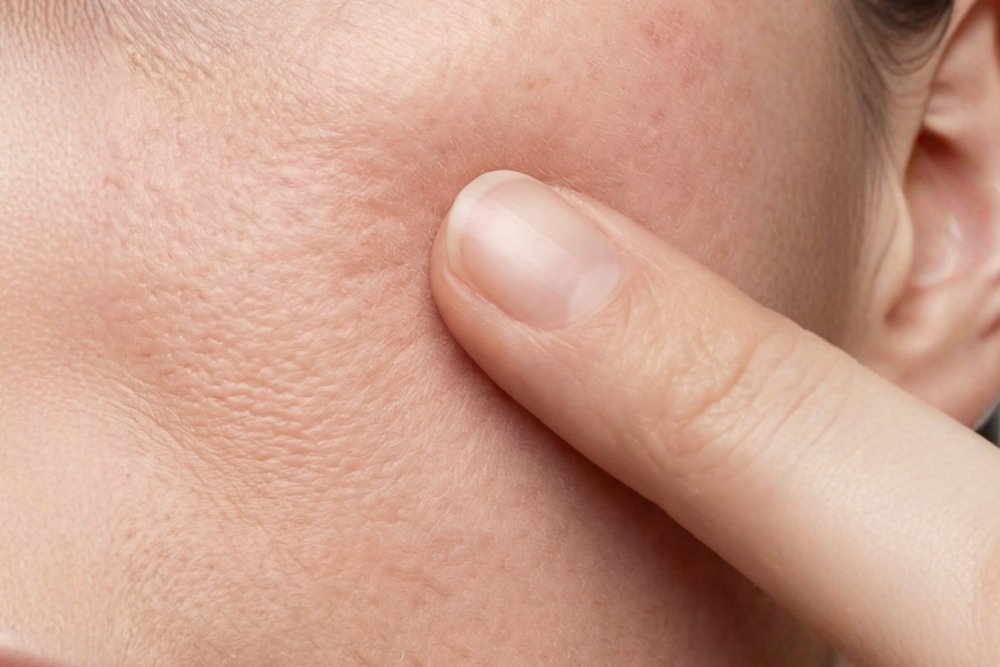 Why Does Air Conditioning Dehydrate Your Skin?