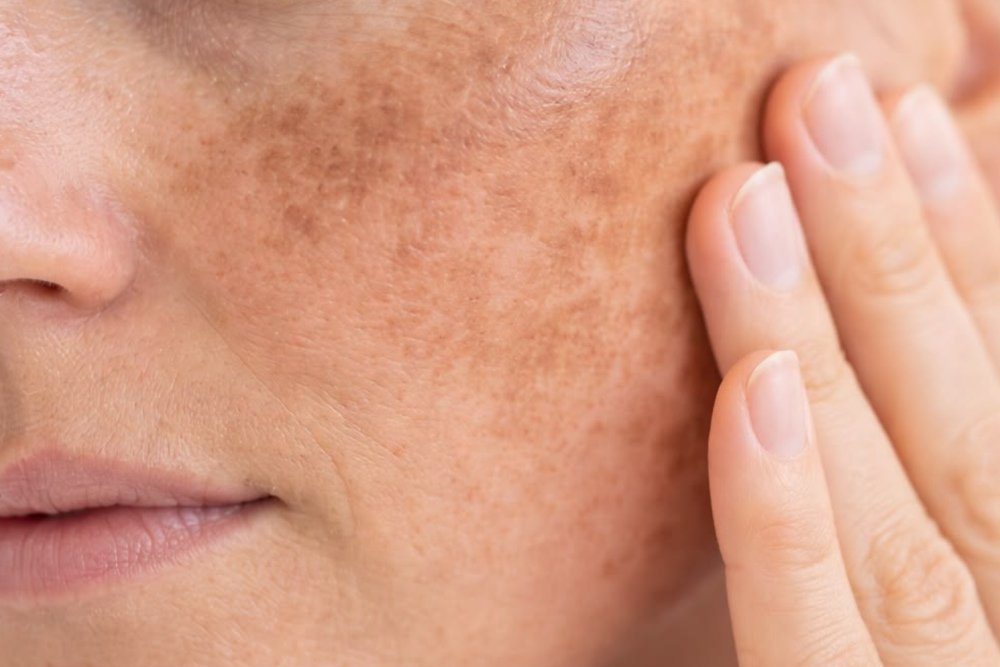 Best Skincare Routine for Indian Skin