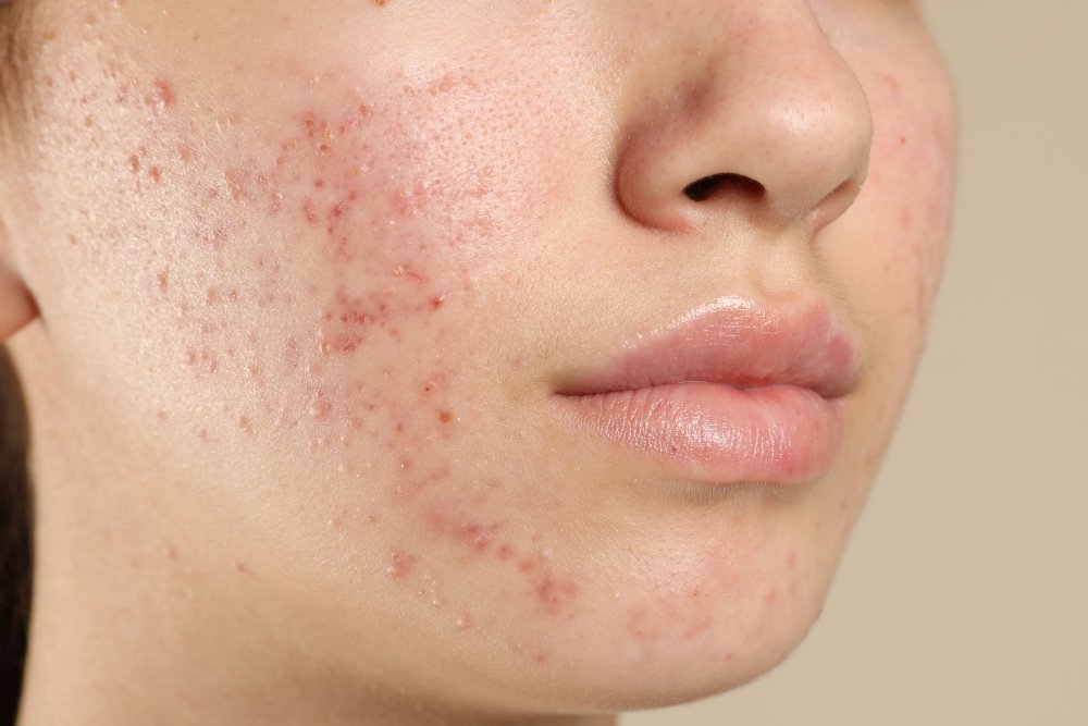 When Should You Visit a Skin Specialist?