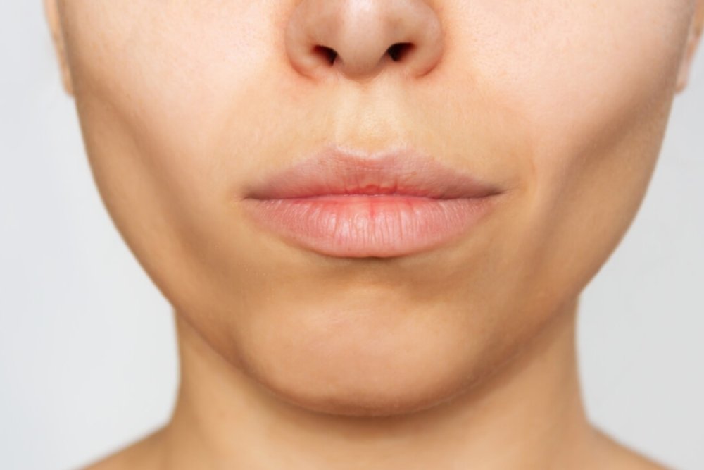 What is Sculptra? Complete Guide to Sculptra Treatment