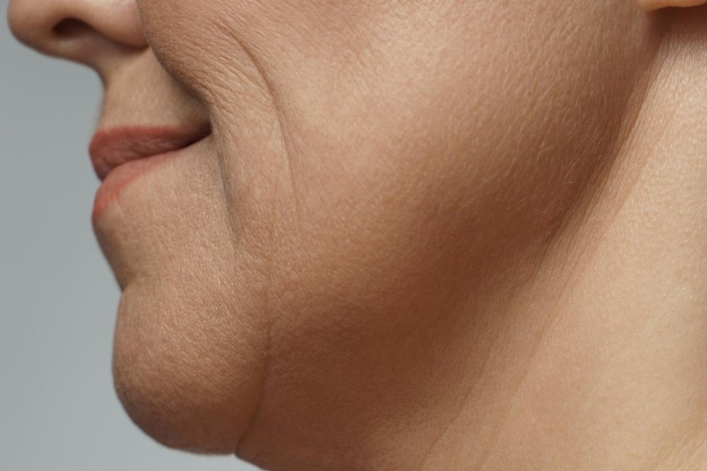 How Does Sculptra Treatment Work?