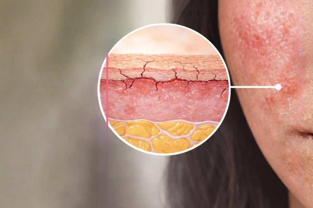 Why Your Skin Barrier Matters So Much