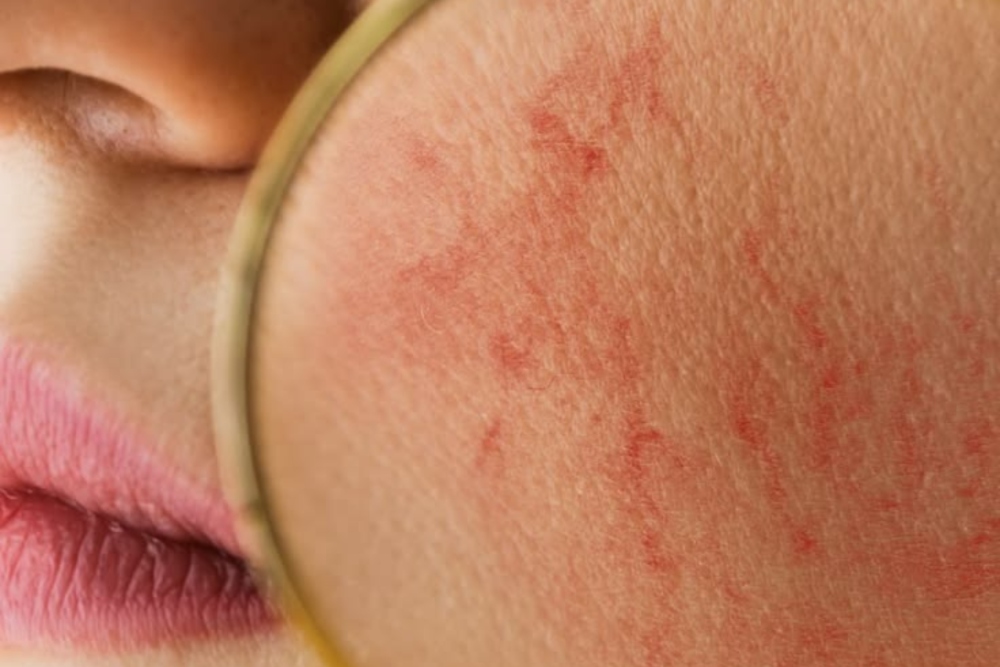 Why Beginners Struggle With Retinol Irritation