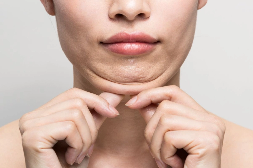 How to Get Rid of a Double Chin: Non Surgical & Surgical Options